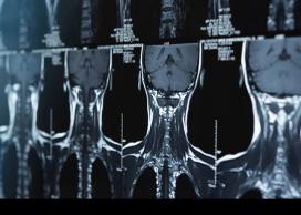 Spinal cord x-ray